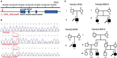 A Non-coding HES1 Variant Predisposes Children to Congenital Heart Disease in Chinese Population